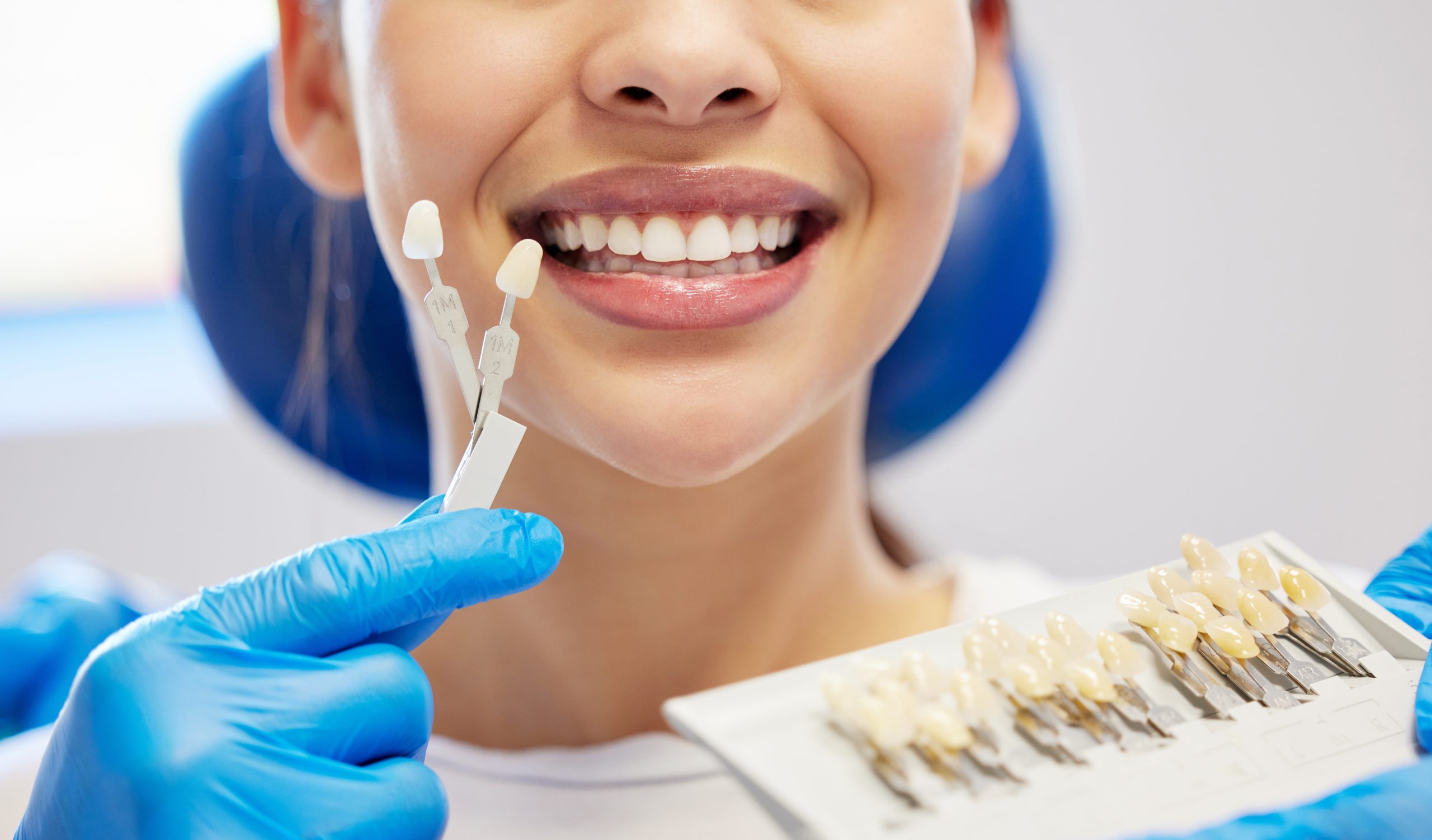 Dental Crowns in One Visit: Discover the CEREC System Revolution ...