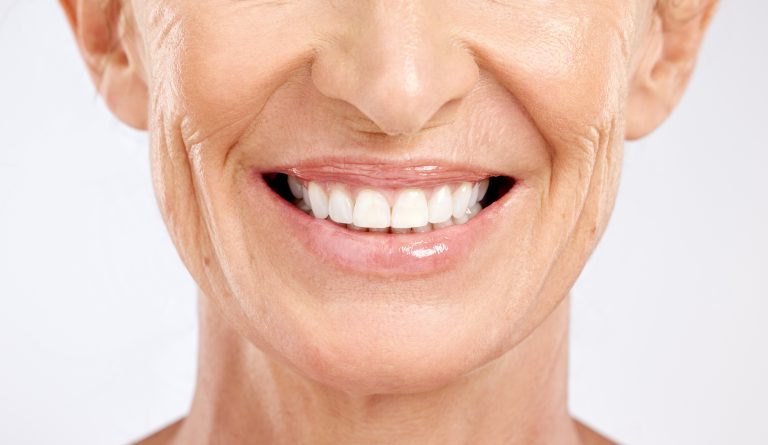 Implantes Dentales