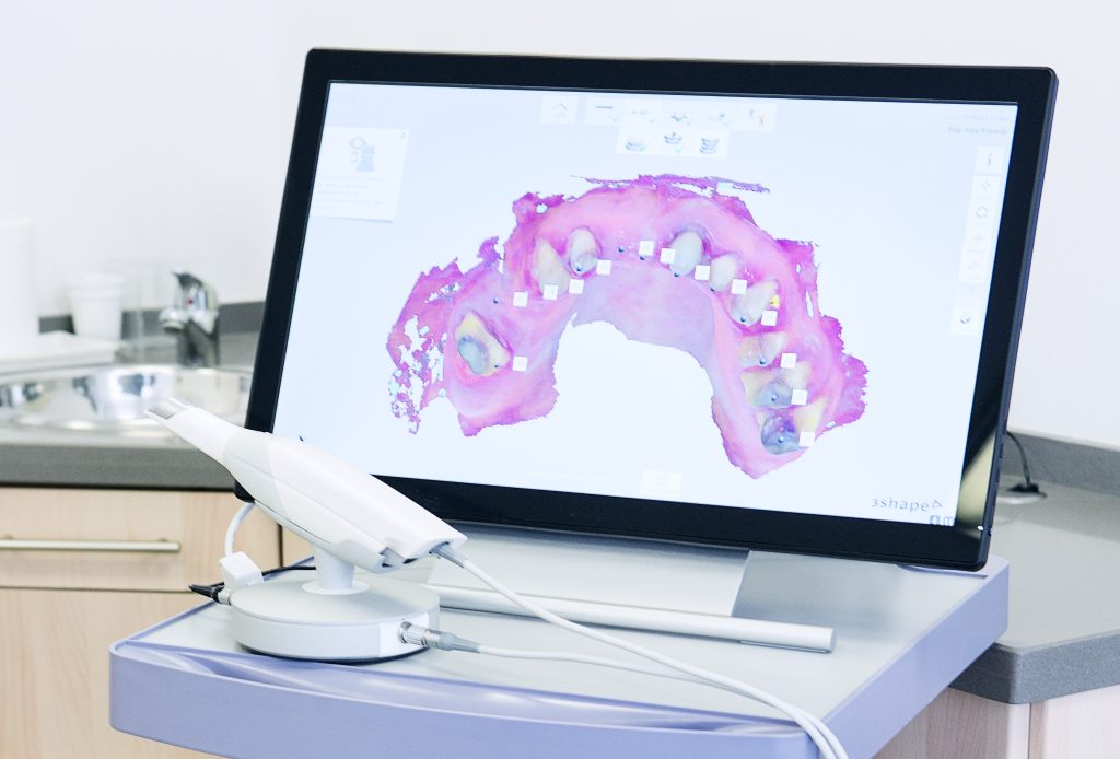 escaneo intraoral