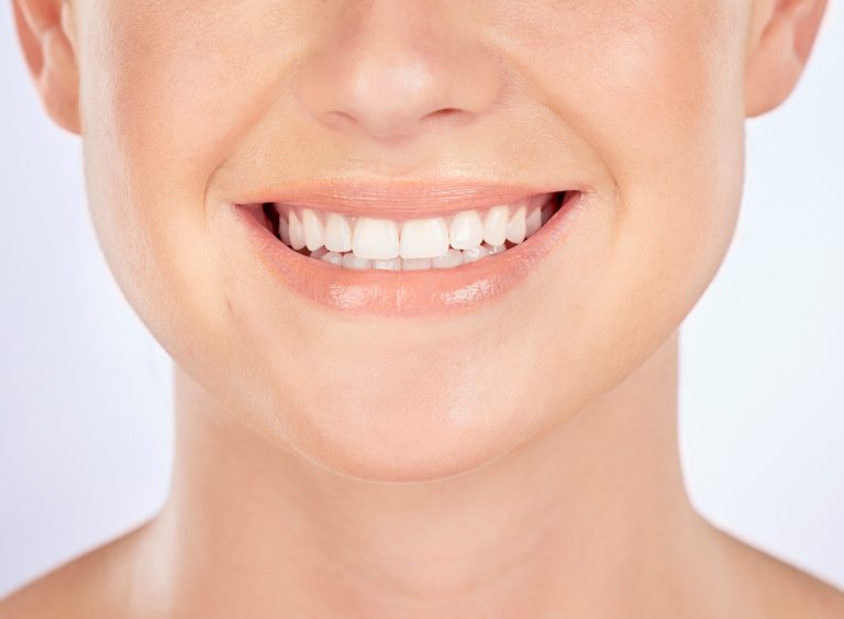 dientes torcidos