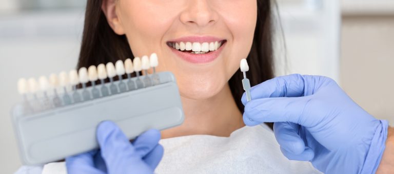 diseño dental