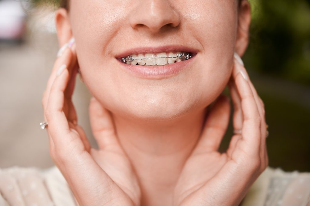 dientes salidos
