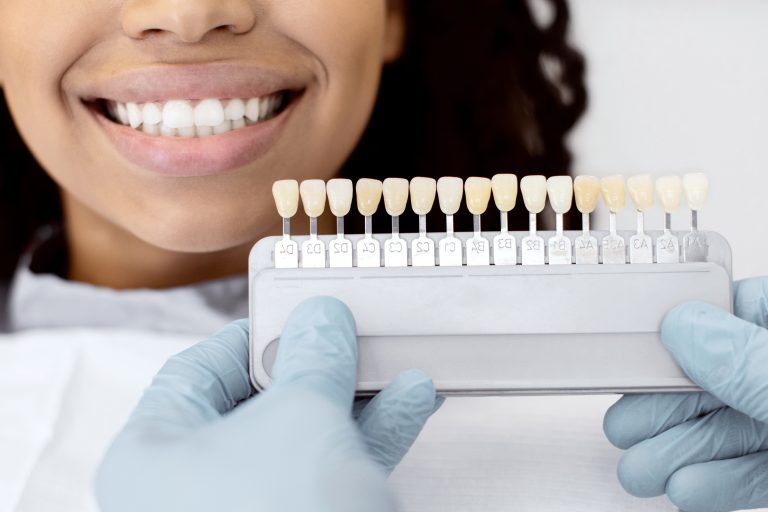 dientes amarillos causas