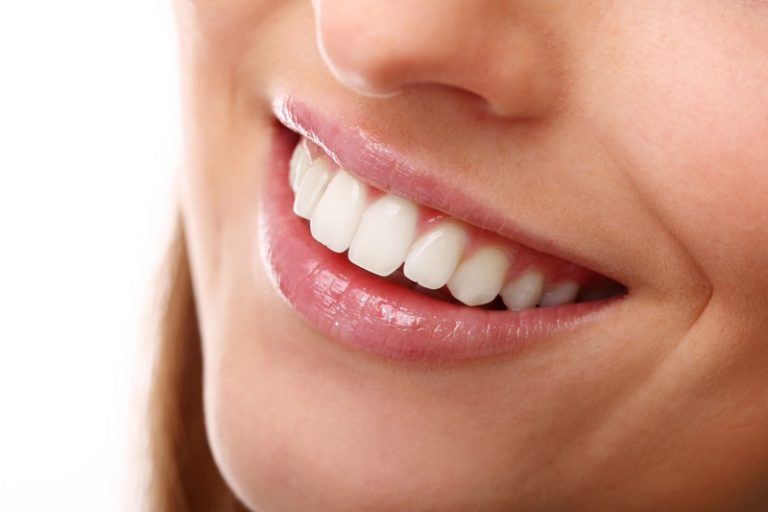 Cómo tener una sonrisa bonita sin brackets