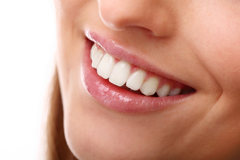 Cómo tener una sonrisa bonita sin brackets